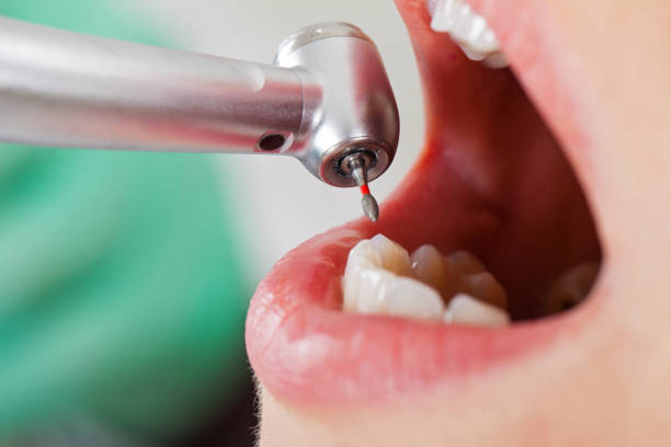 Best 24-Hour Emergency Dental Care in Nevada, TX